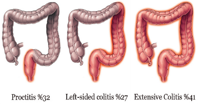 2020-04-29 01-30-08 View Image - Opera-min.png